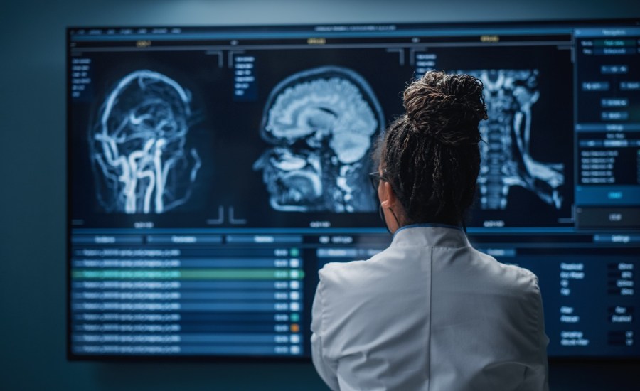 doctor looking at screens displaying MRI brain scans